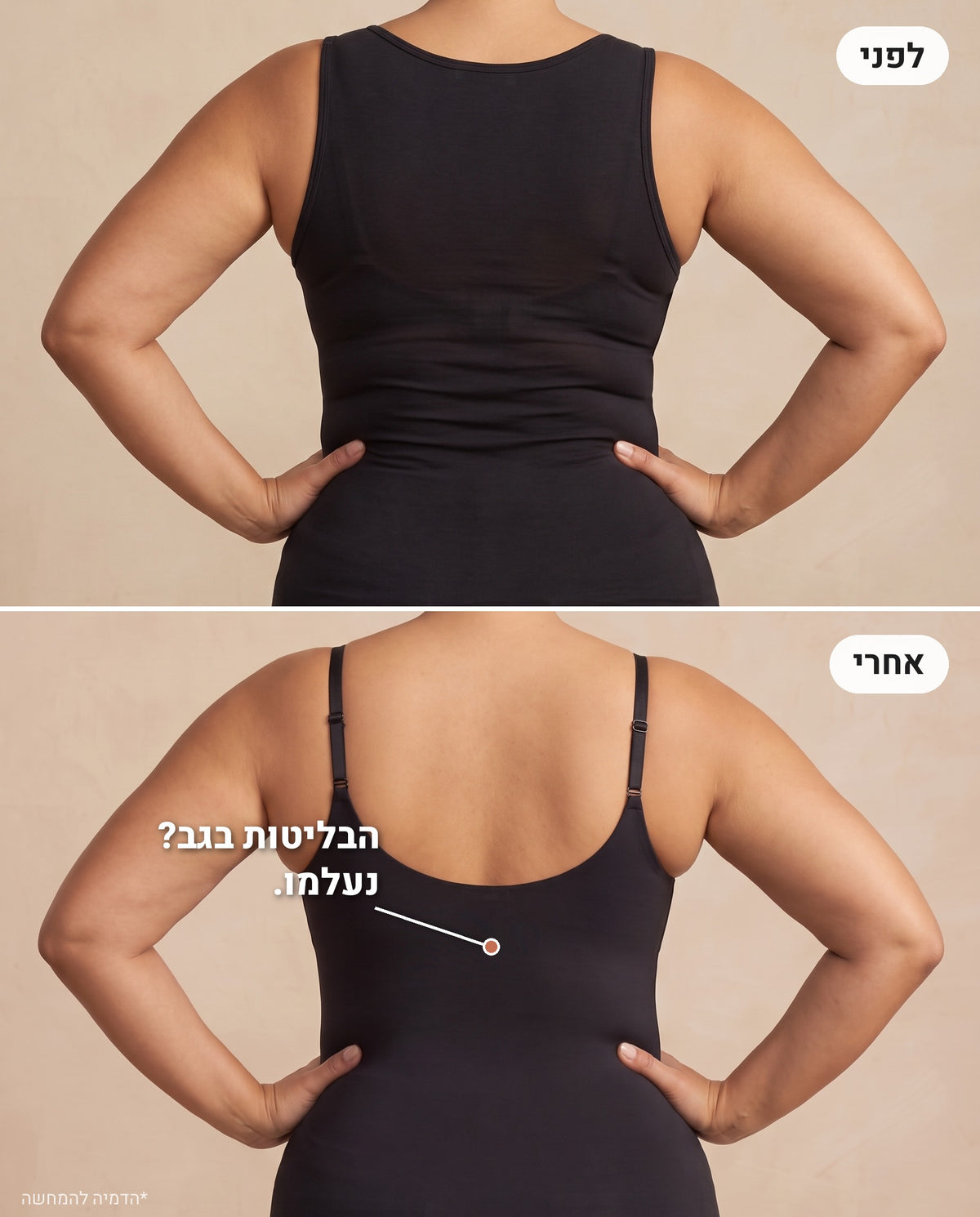 לפני ואחרי - מהגב, בלי בליטות